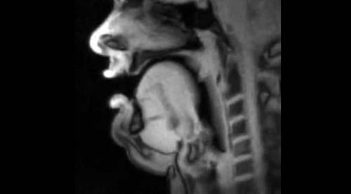 real-time MRI of the tongue when singing [click to view]
