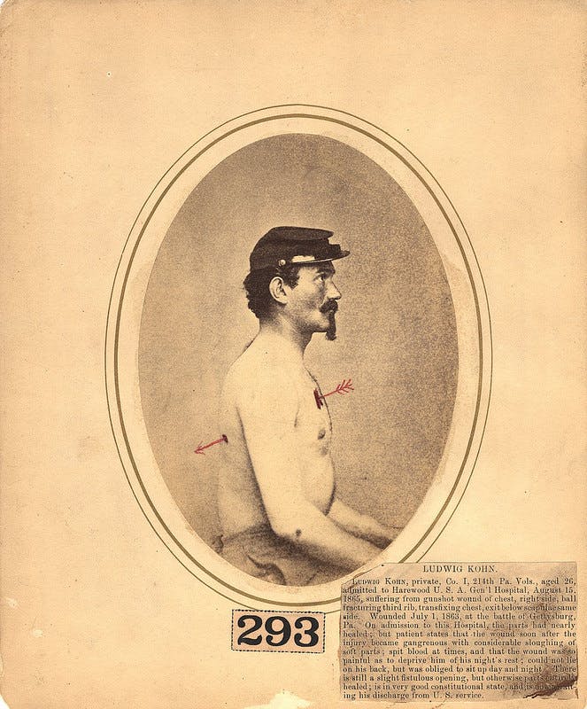 Reed Bontecou, "Ludwig Kohn, a 26-year-old private wounded at the battle of Gettysburg in July 1863." Annotated photograph, 1865.