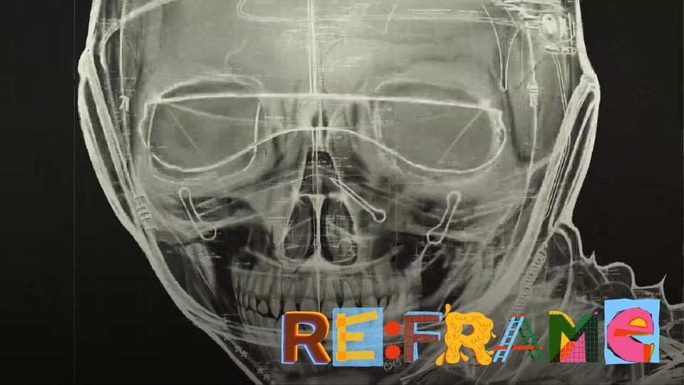 Where's your head at?