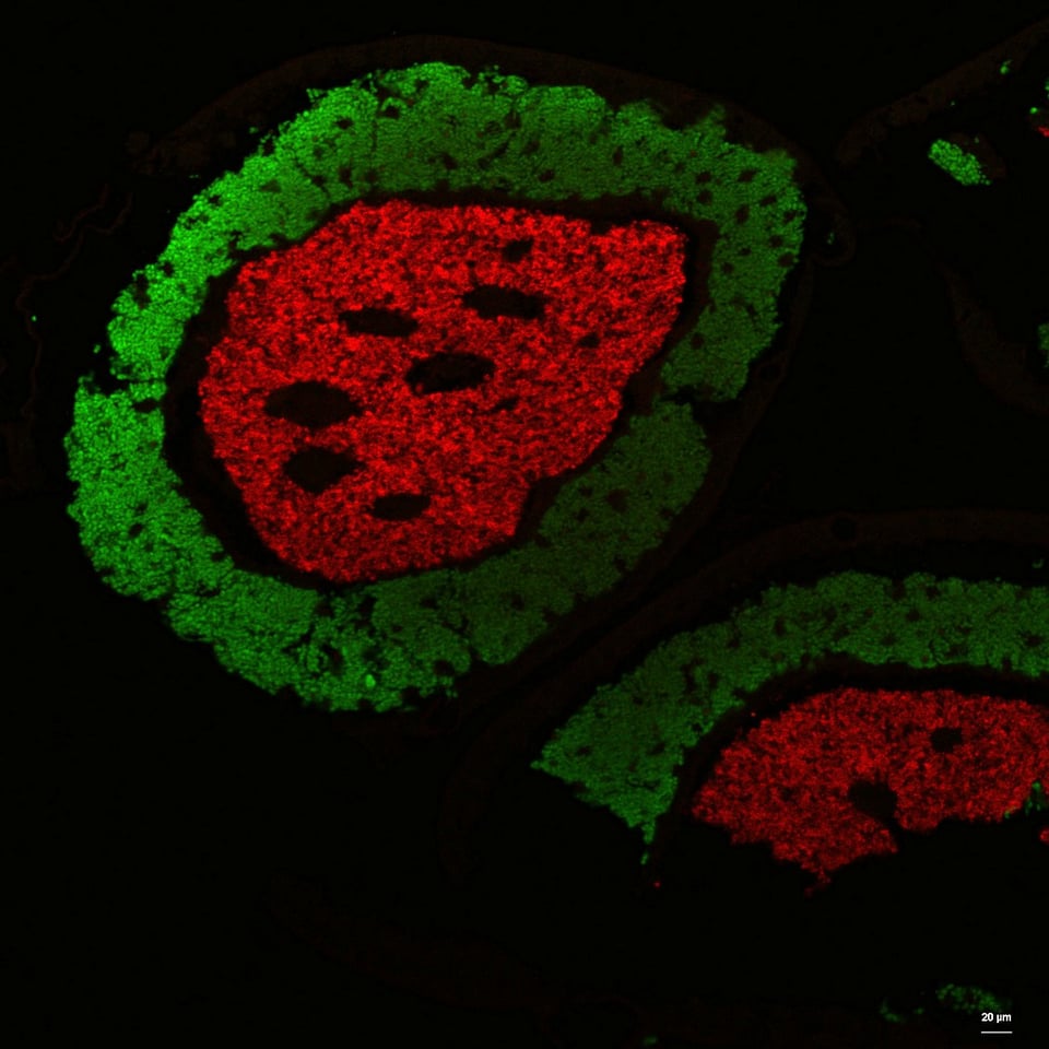A micrograph showing a ring of bacterial cells glowing green surrounding a round mass of bacterial cells glowing red