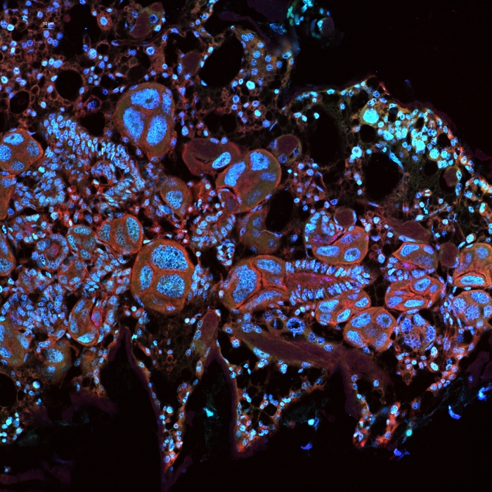 An image of fluorescent animal cells in red and blue taken with a microscope