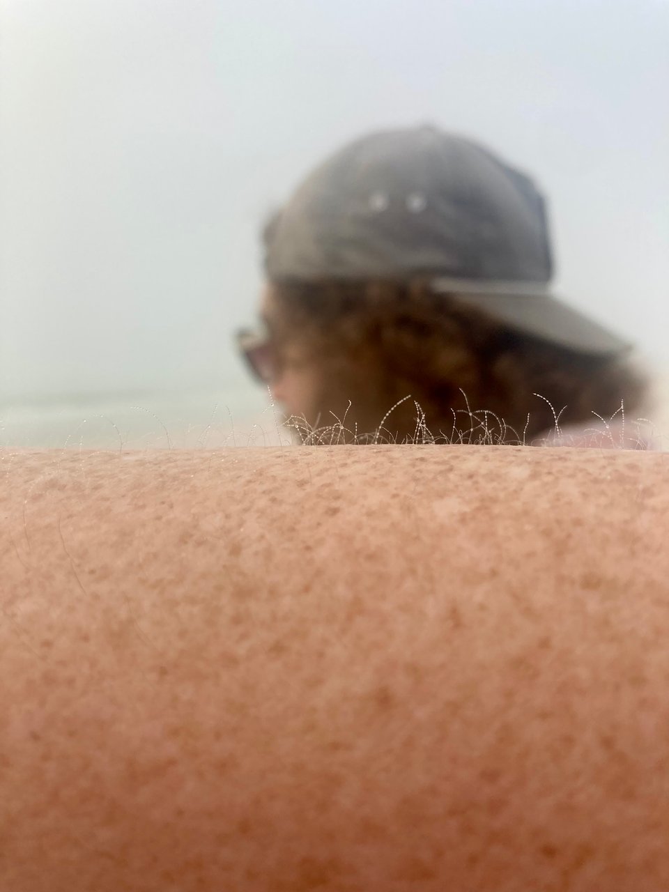 Close view of an arm, with hair standing up and covered in beads of moisture. A man's head is in the background.