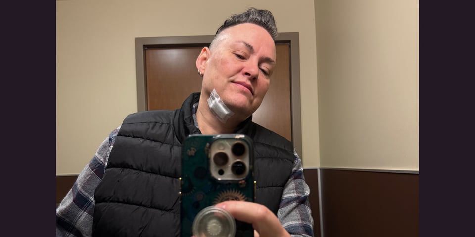 Leoh post neck procedure