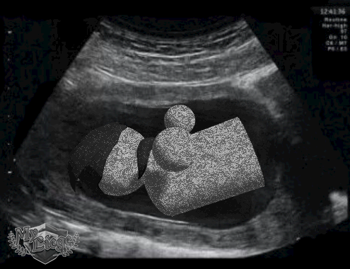The meeple version of myself in an ultrasound, as if I was announcing a baby but instead I'm just announcing a video game.