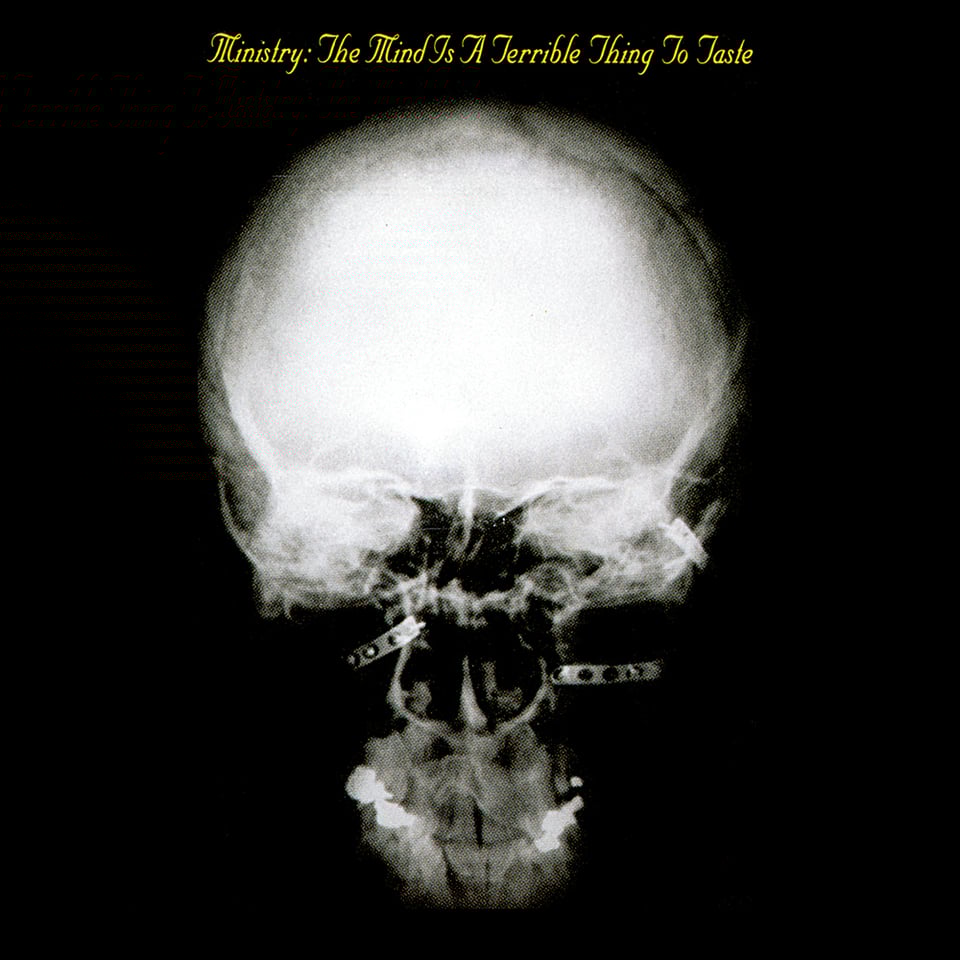 On a black background, an X-ray of a human skull. There appear to be metal bracers or attachments of some kind within the flesh of the head, two near the nasal area and one on the right side near where the ear would be.