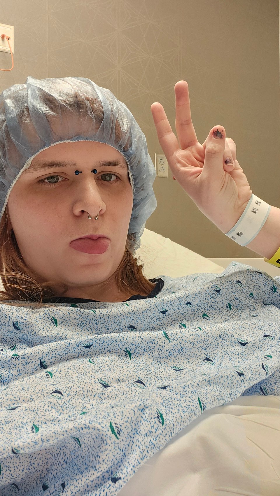 Selfie of me in a hospital gown before my procedure