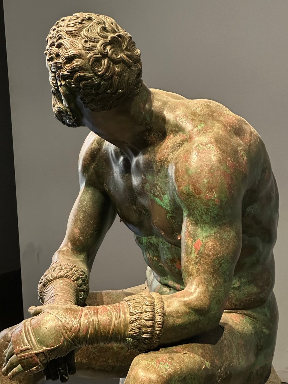 detail photo of the bronze sculpture The Boxer At Rest, from its left side, looking at its arm, back and back of its head, which is turned away from the viewer