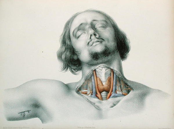 "Cross Section of a Throat" by Nicolas Henri Jacob. A drawing from the early 1800s of a cadaver of a young French man with a goatee and curly hair, his chest bare, with a cut on the tricep and the throat cut open.