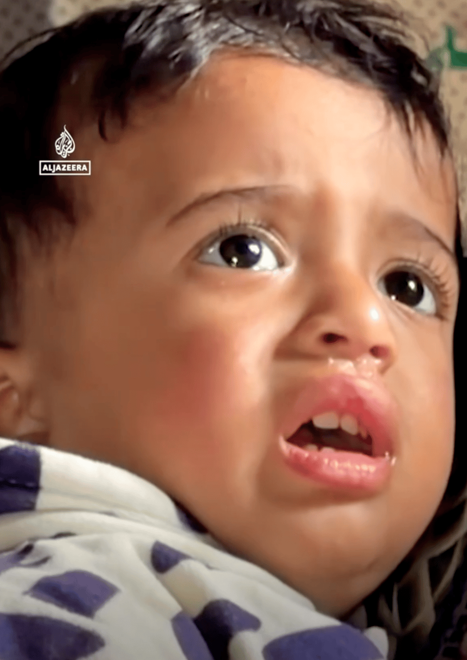 An image of a baby of about 21 months, with dark hair and dark brown eyes, who looks scared