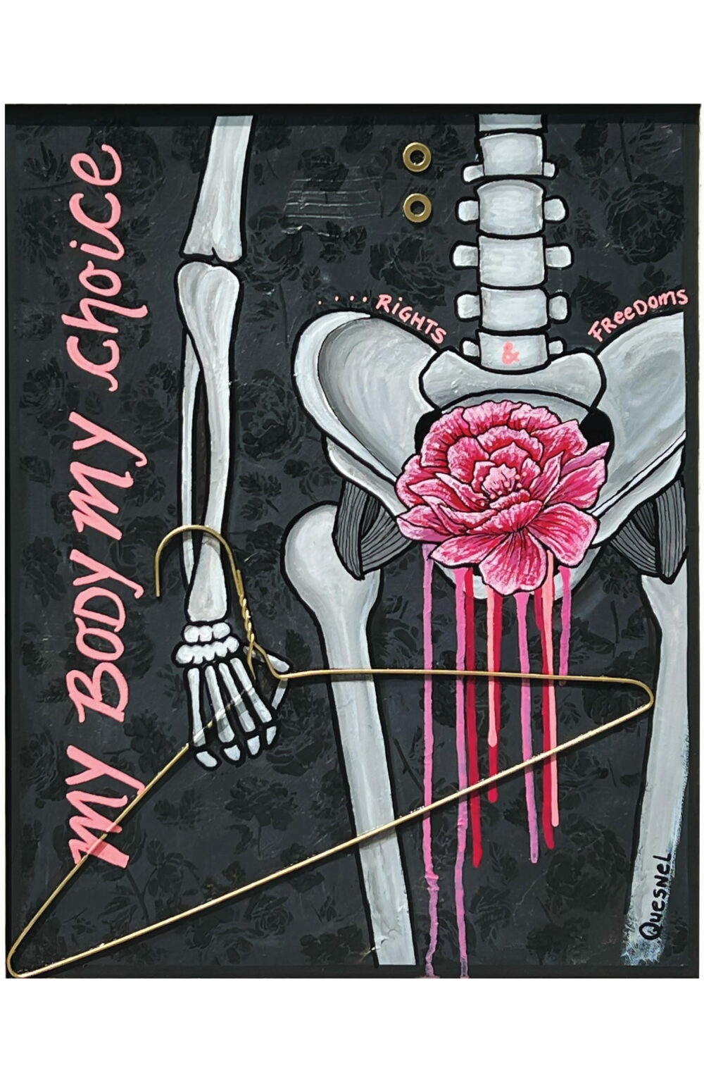 Abortion, Underground