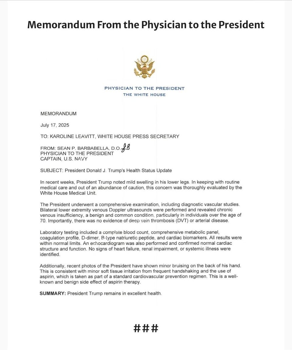 Trump’s Physician says he has a venous condition