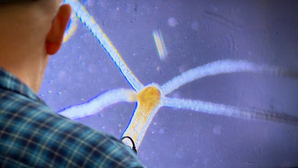 A person observing a detailed microscopic image of a hydra on a screen.