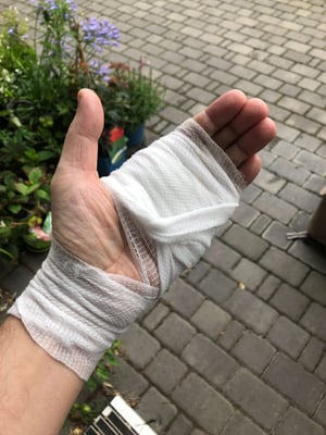 hand bandaged