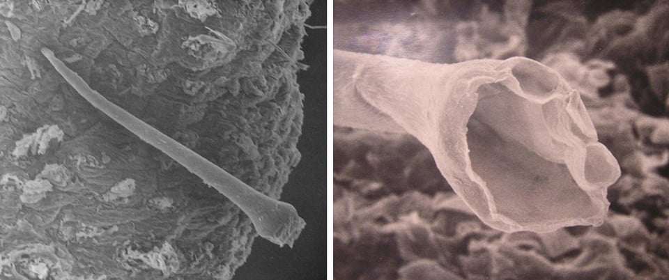 Left: Exposed skin sample at ×100 magnification. The spicule from the nettle plant is seen penetrating the skin surface. Right: View of the base of a nettle spicule protruding from the skin surface magnified ×500. / Cummings AJ, Olsen M. “Mechanism of Action of Stinging Nettles” in Wilderness & Environmental Medicine. 2011.