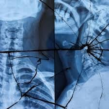 Self-Driving cars are simply safer.