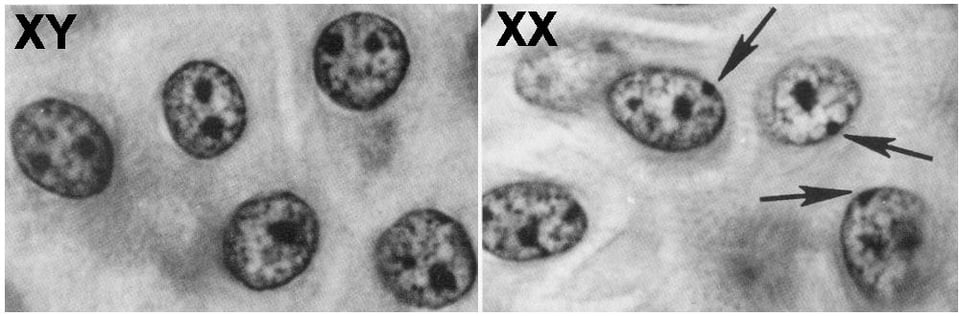 Two black and white images side by side. Each of them has four or five cells inside. On the left, labeled XY, the cells have dark spots in them, but none that touch the membrane of the cell. On the right, labeled XX, there are little arrows, showing the dark dots that do intersect with the cell membrane.