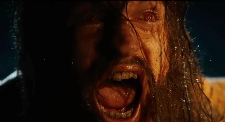 Close-up of an infected zombie from 28 Years Later, its long, wet hair clinging to a dirt-smeared face as it screams in primal rage. Its bloodshot eyes glow an eerie, inhuman red, and yellowed, broken teeth fill its wide-open mouth. The lighting is dark and chaotic, underscoring the infected’s raw, animalistic fury as it lunges toward its next victim.