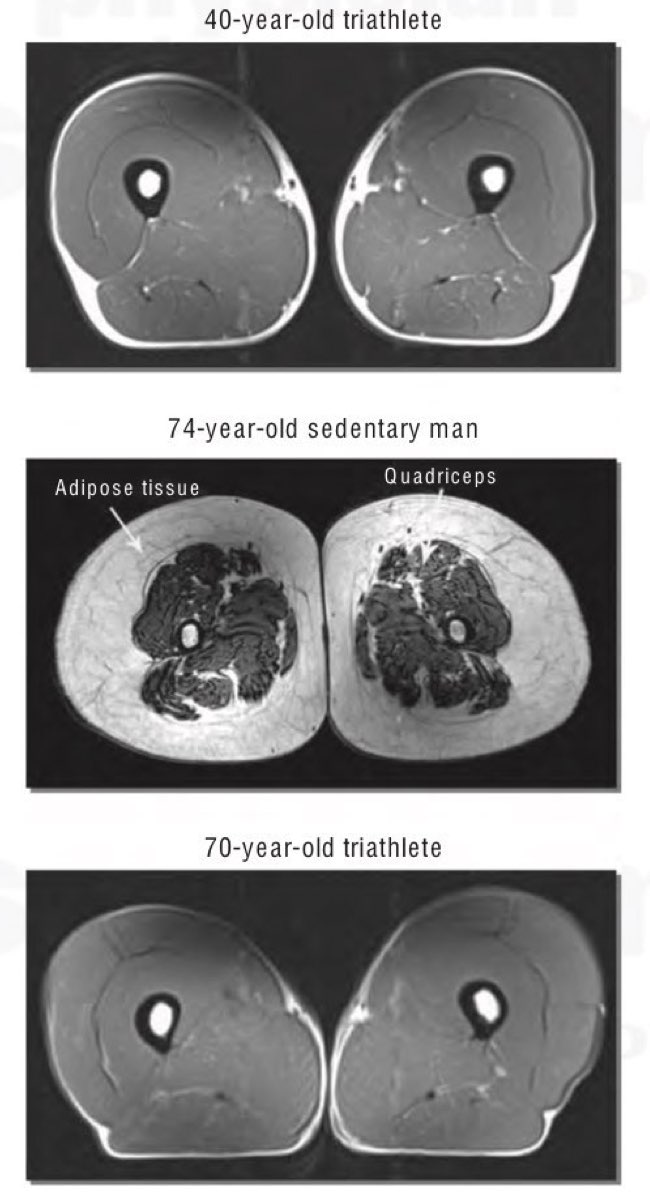 The difference in muscle mass between 40 year old triathlete, a 74 year old sedentary man and a 70 year old triathlete.